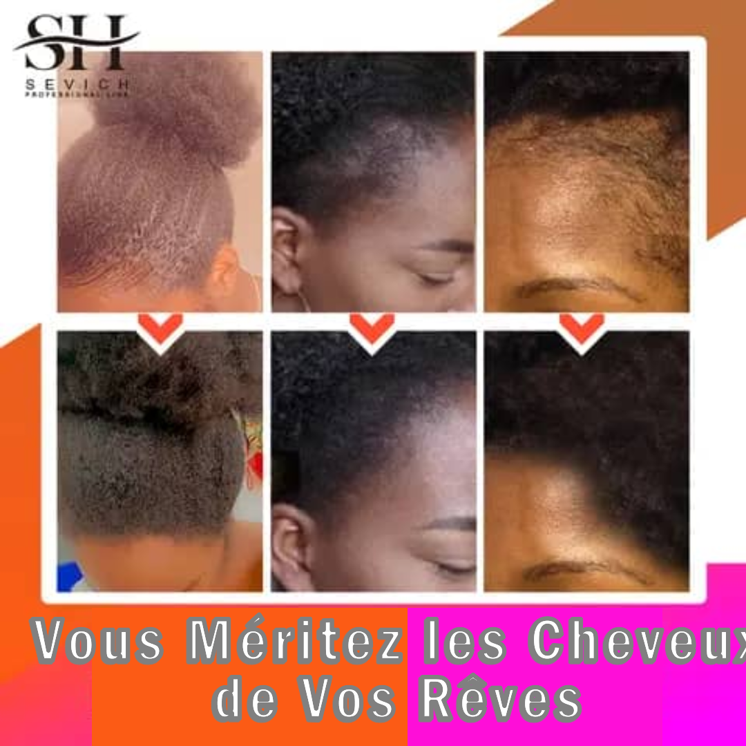 chebe hair oil (hommes et femmes) 1 acheté et 1 offert